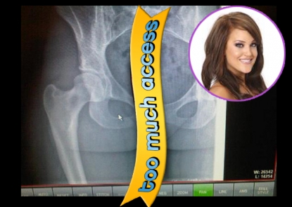 Lacey Schwimmer’s X-ray
