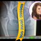 Lacey Schwimmer’s X-ray