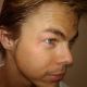 Derek Hough shows off a cut he sustained during ‘Dancing’ practice, March 11, 2010