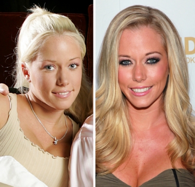 Kendra Wilkinson in 2004 (left) and in 2011 (right)