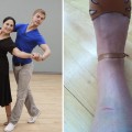 Ricki Lake and Derek Hough rehearse (left) and Ricki’s injury (right)