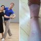 Ricki Lake and Derek Hough rehearse (left) and Ricki’s injury (right)