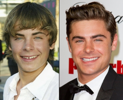 Zac Efron in 2004 (left) and in 2012 (right)
