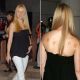 Gwyneth Paltrow’s back showed signs of cupping in 2004
