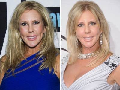 ‘The Real Housewives of Orange County’s’ Vicki Gunvalson appears on Bravo’s ‘Watch What Happens Live’ on April 1, 2013 / Vicki Gunvalson pre-surgery on May 4, 2012