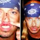 Bret Michaels’ injuries following the 2009 Tony Awards opening number